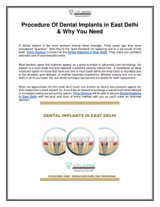 procedure of dental implants in east delhi