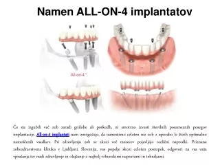 namen all on 4 implantatov