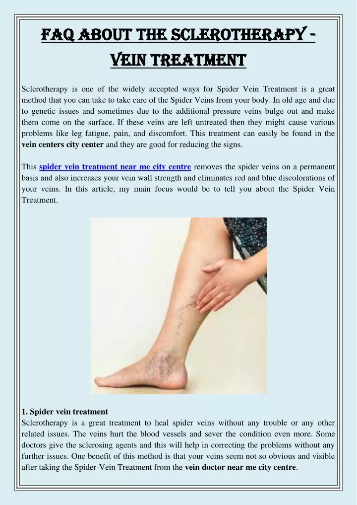faq about the sclerotherapy faq about