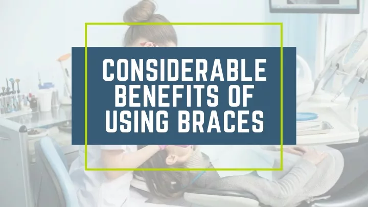 considerable benefits of using braces