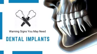 Impressive Implants For Oral Health