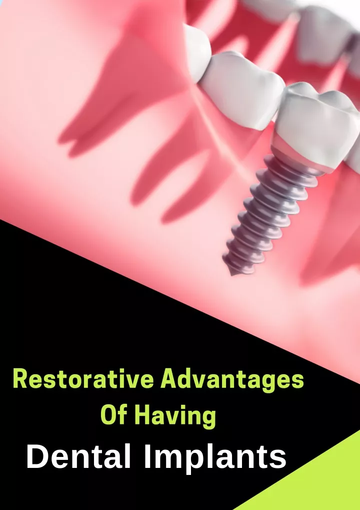 restorative advantages of having dental implants