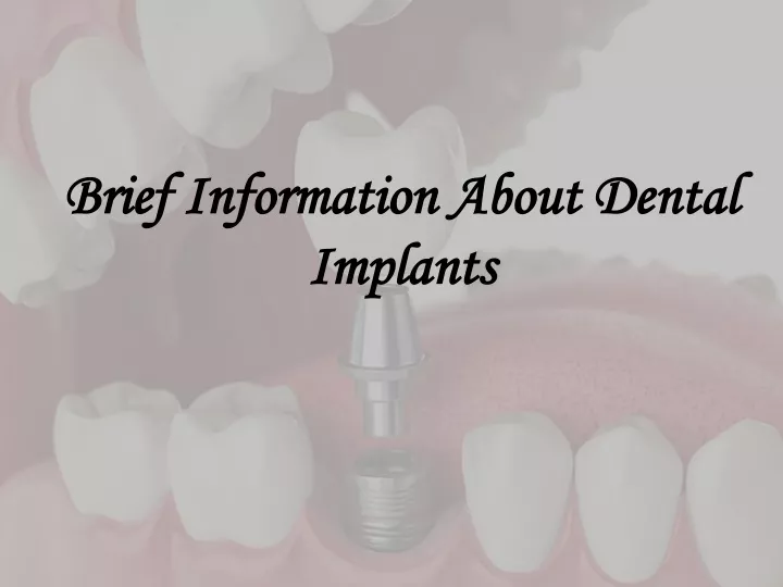 brief information about dental implants
