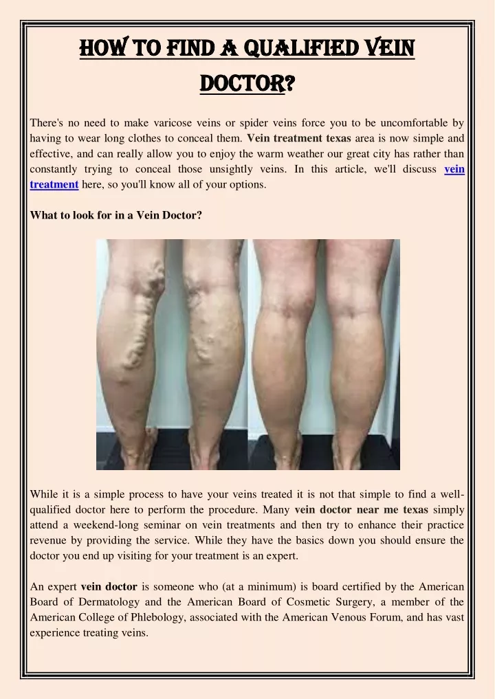 how to find a qualified vein how to find