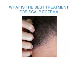 what is the best treatment for scalp eczema