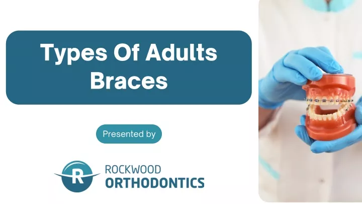 types of adults braces