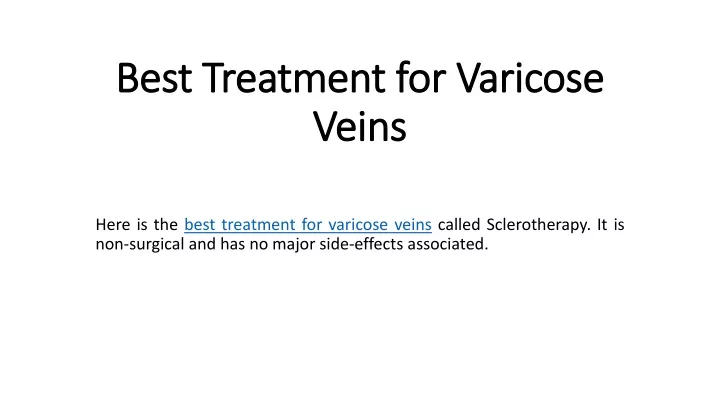 best treatment for varicose veins