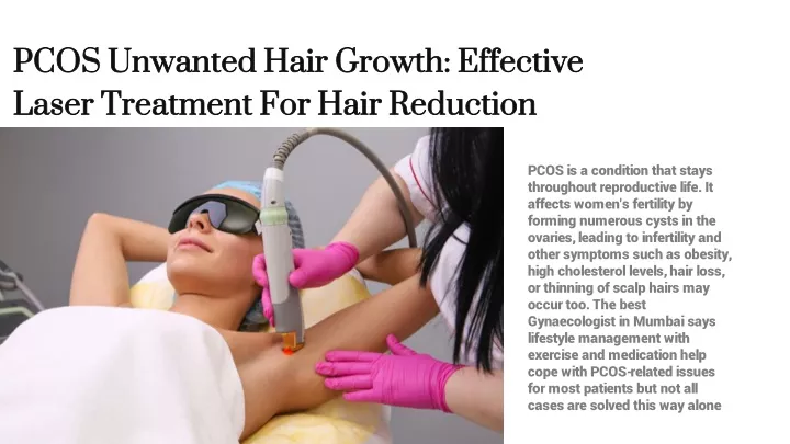 pcos unwanted hair growth effective laser
