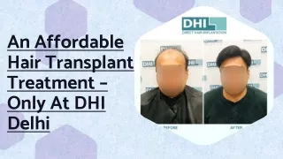 An Affordable Hair Transplant Treatment – only at DHI Delhi