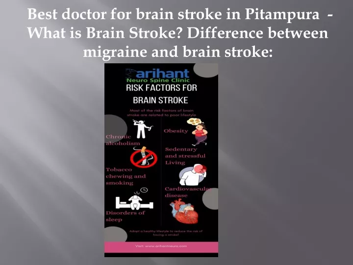 best doctor for brain stroke in pitampura what