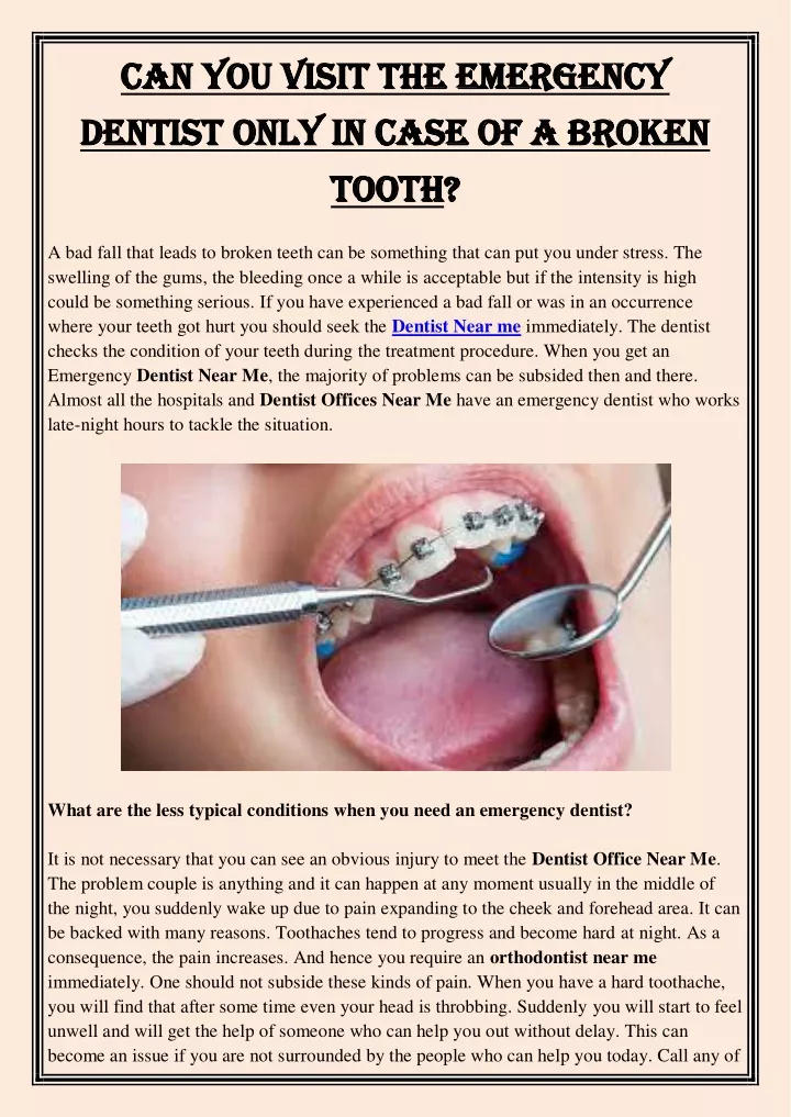Ppt Can You Visit The Emergency Dentist Only In Case Of A Broken Tooth Powerpoint Presentation
