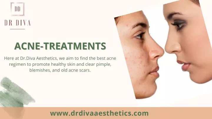 acne treatments acne treatments
