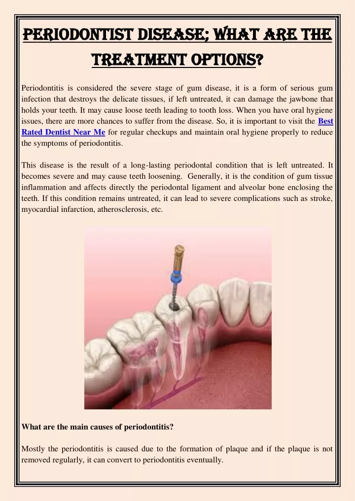 periodontist disease what are the periodontist