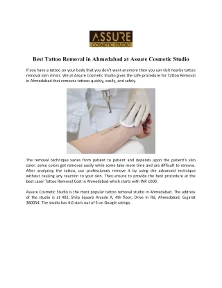Best Tattoo Removal in Ahmedabad at Assure Cosmetic Studio