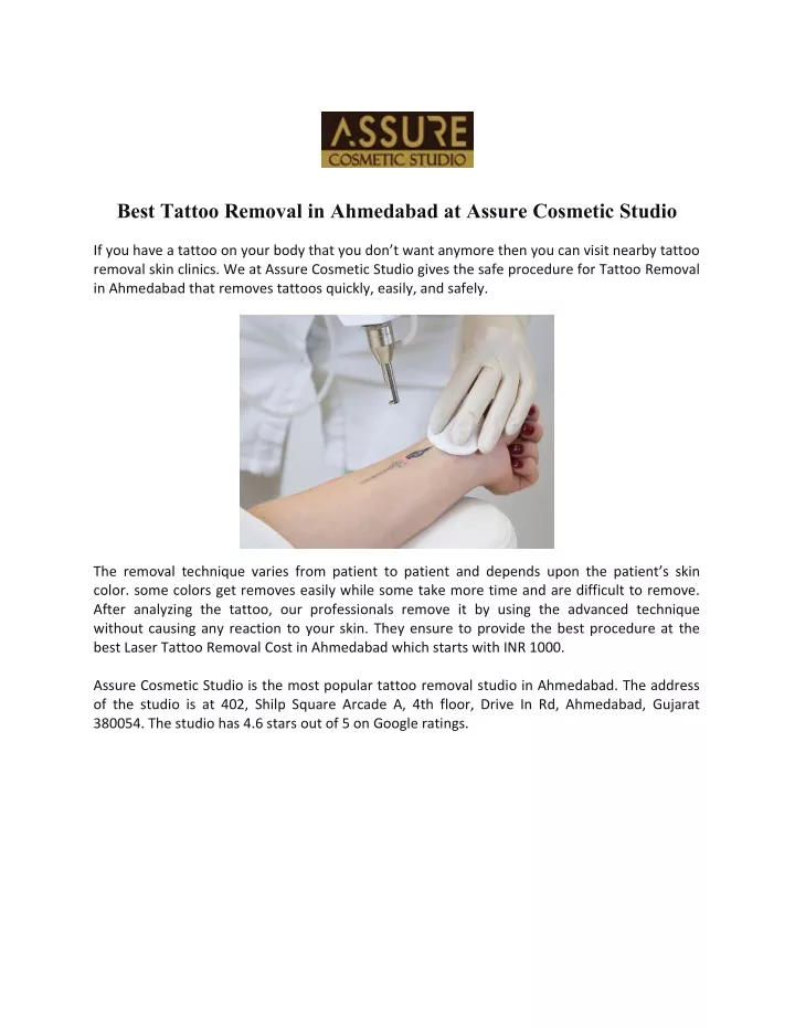 best tattoo removal in ahmedabad at assure