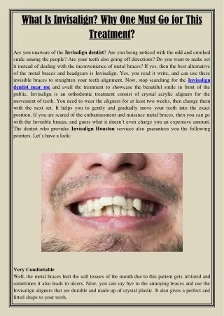 what is invisalign why one must go for this