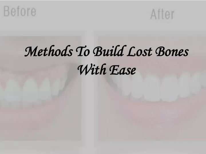 methods to build lost bones with ease