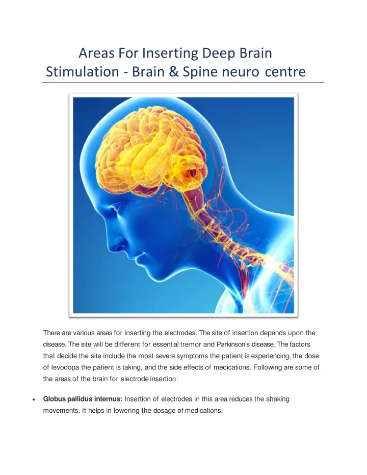 areas for inserting deep brain stimulation brain spine neuro centre