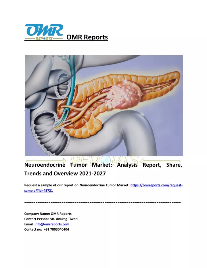 omr reports