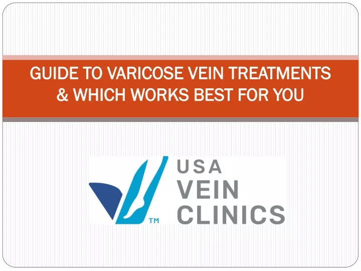 guide to varicose vein treatments which works best for you