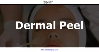 The perfect derma peel benefits at Center for Anti-Aging MedSpa