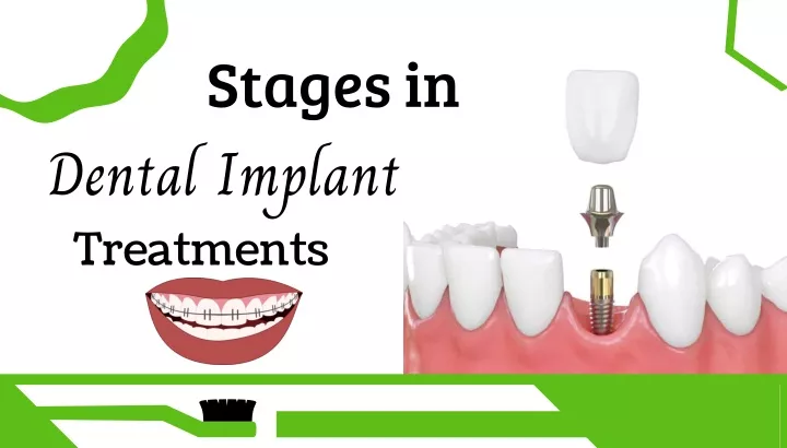 stages in