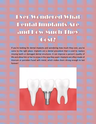 Ever Wondered What Dental Implants Are and How Much They Cost_