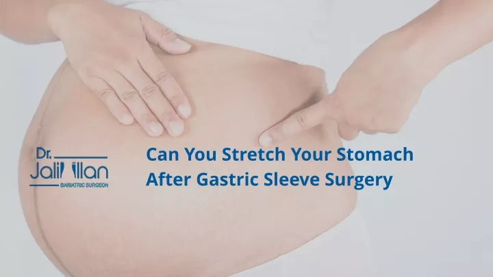 can you stretch your stomach after gastric sleeve