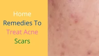 Home Remedies To Treat Acne Scars