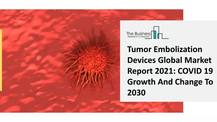 tumor embolization devices global market report