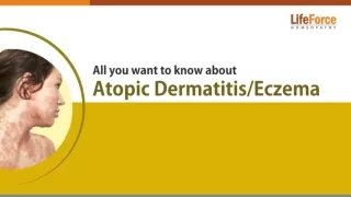 Know Everything About Atopic Dermatitis Eczema