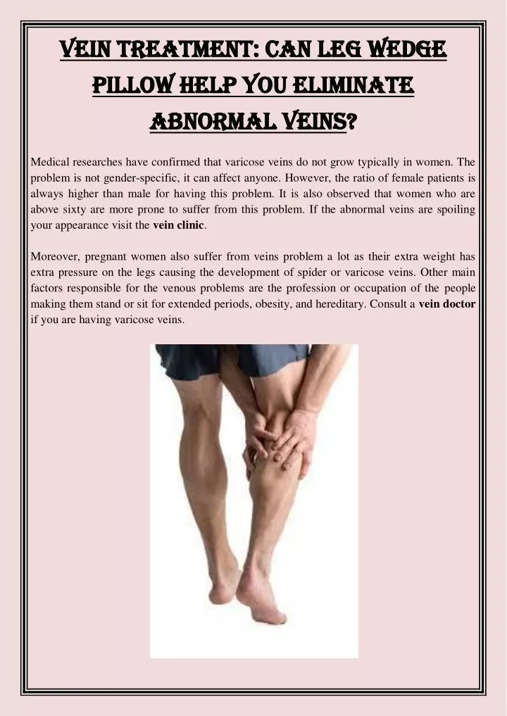 vein treatment can leg wedge vein treatment