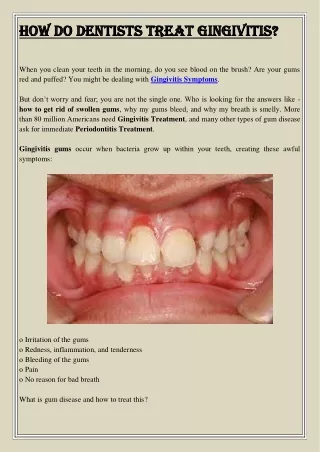 how do dentists treat gingivitis how do dentists
