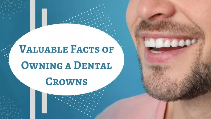 valuable facts of owning a dental crowns