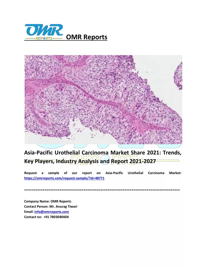 omr reports