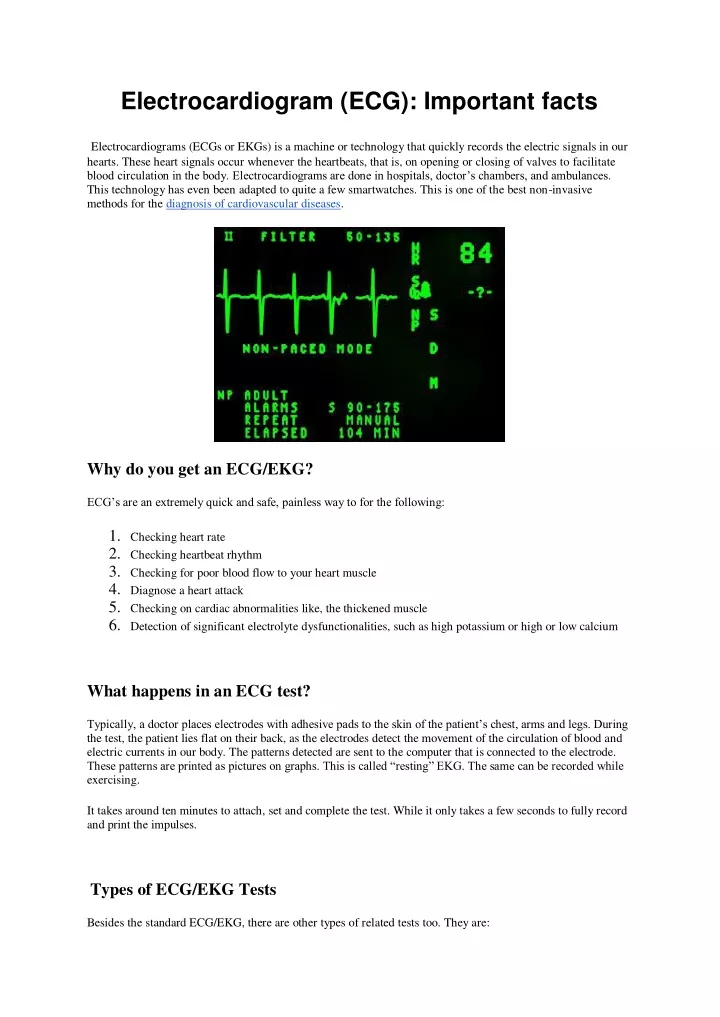 electrocardiogram ecg important facts