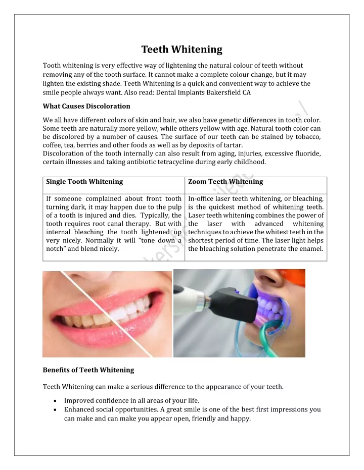 teeth whitening