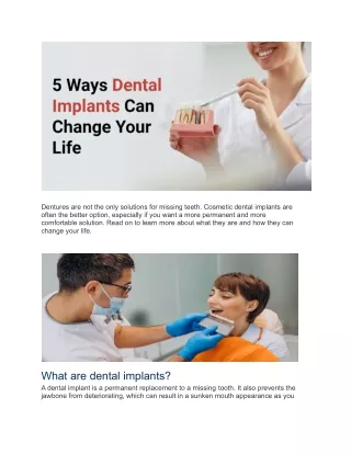 5 Ways Cosmetic Dental Implants Can Change Your Life Forever