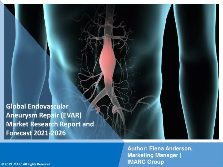 global endovascular aneurysm repair evar market