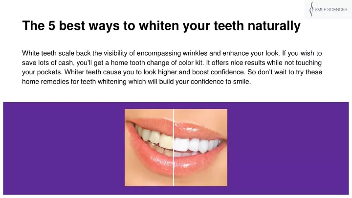 the 5 best ways to whiten your teeth naturally
