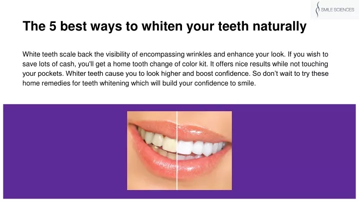 Ppt The 5 Best Ways To Whiten Your Teeth Naturally Powerpoint