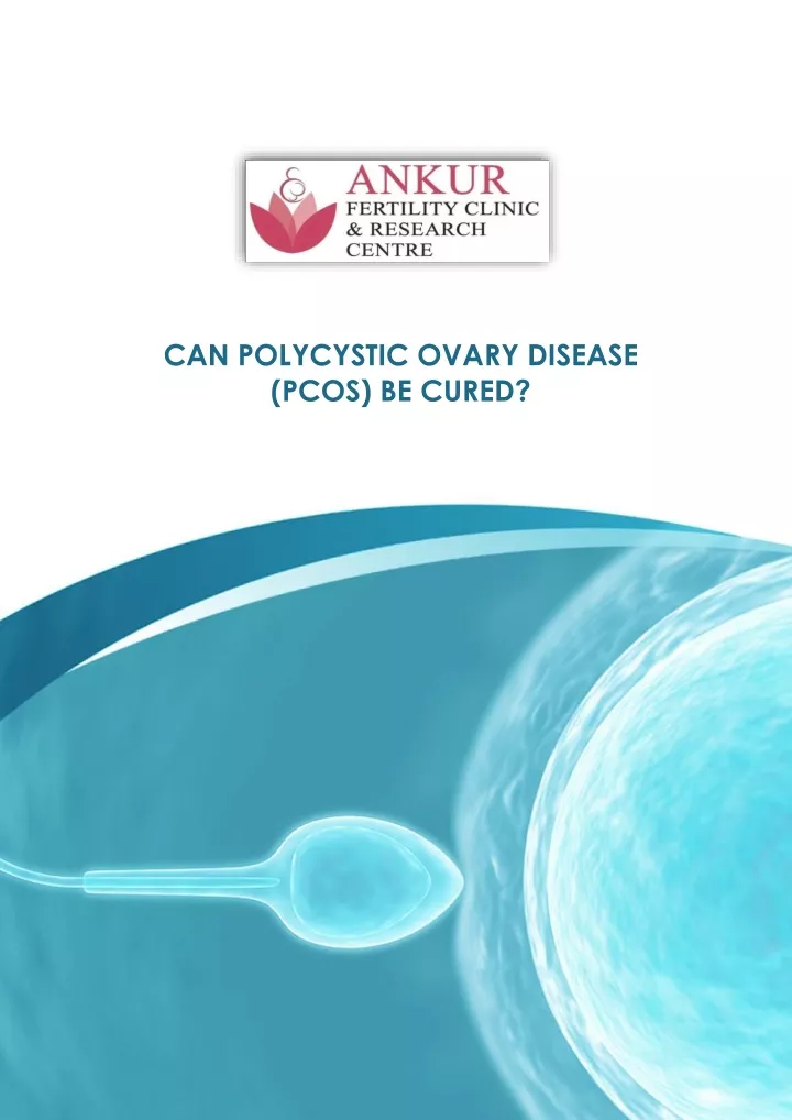 can polycystic ovary disease pcos be cured