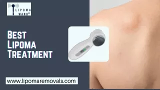 Now, Lipoma removals are no more difficult with a lipoma wand. An effective home