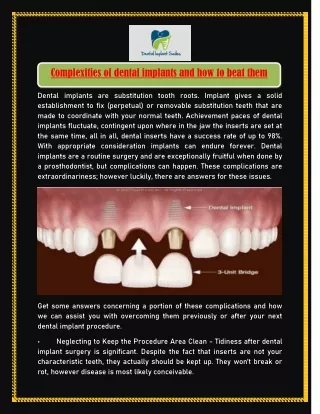 complexities of dental implants and how to beat