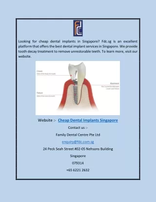 Cheap Dental Implants SingaporeCheap Dental Implants Singapore | Fdc.sg