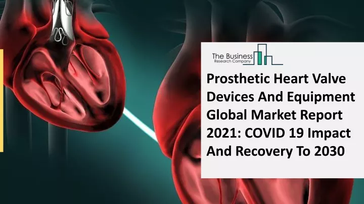 prosthetic heart valve devices and equipment