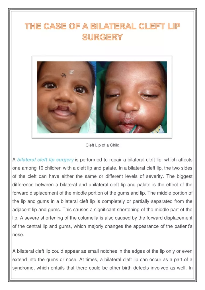 cleft lip of a child