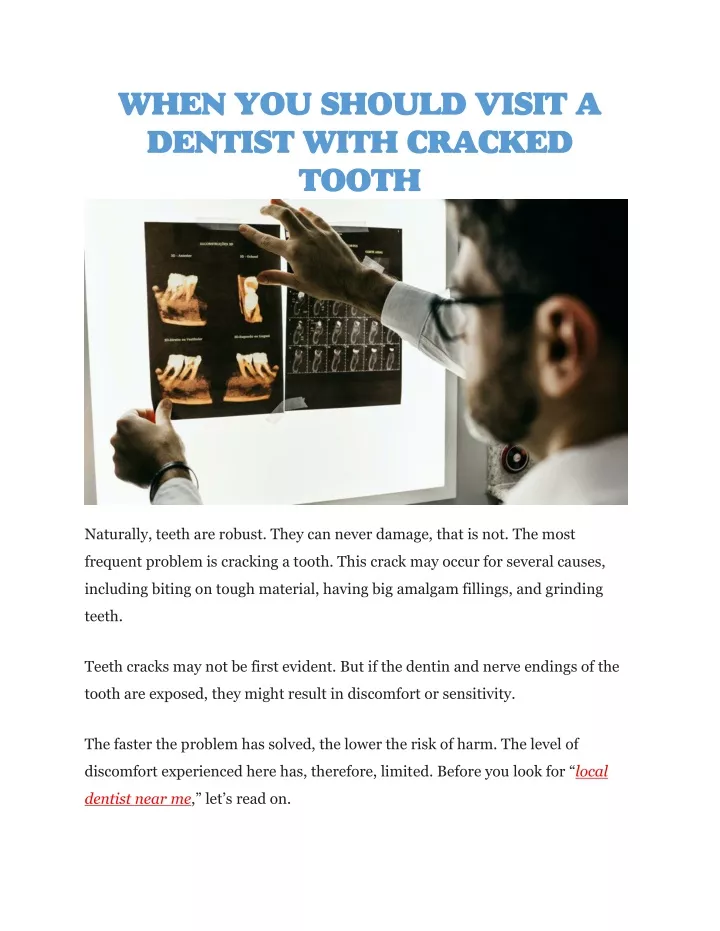when you should visit a dentist with cracked tooth