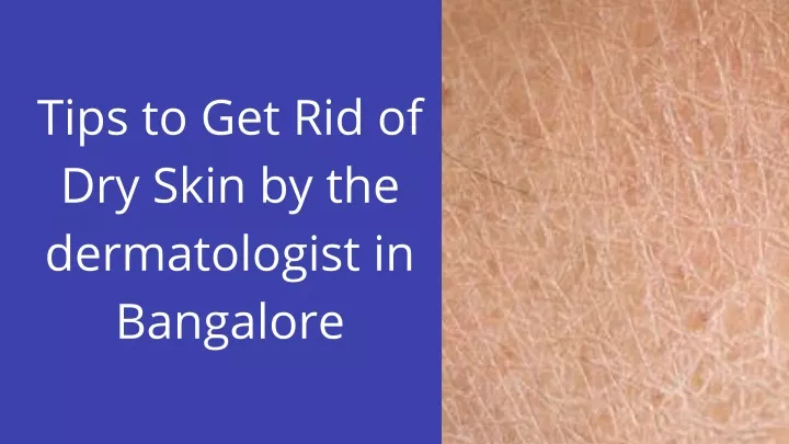 tips to get rid of dry skin by the dermatologist