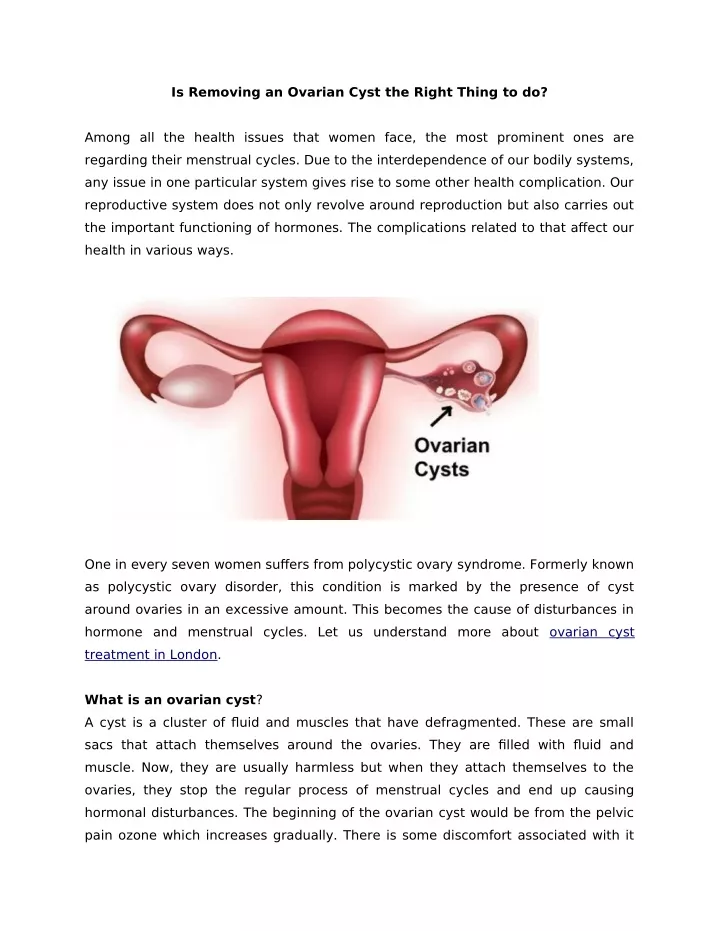 is removing an ovarian cyst the right thing to do